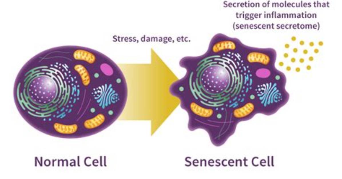 When Does a Cell Become Senescent?