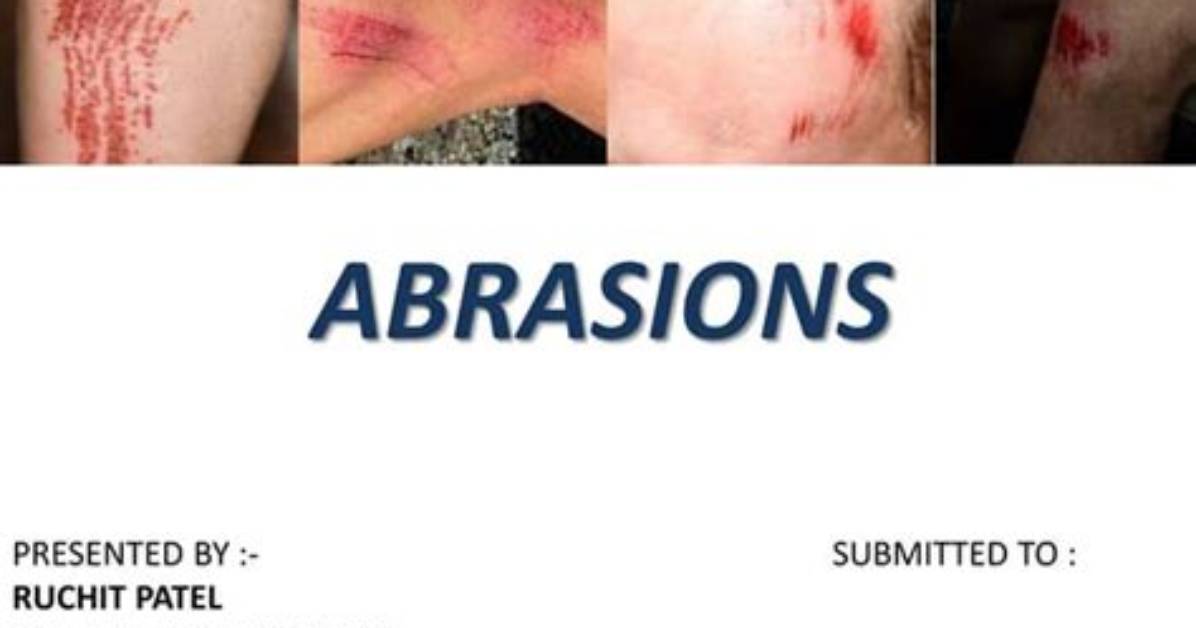 When Does Abrasion Mean?
