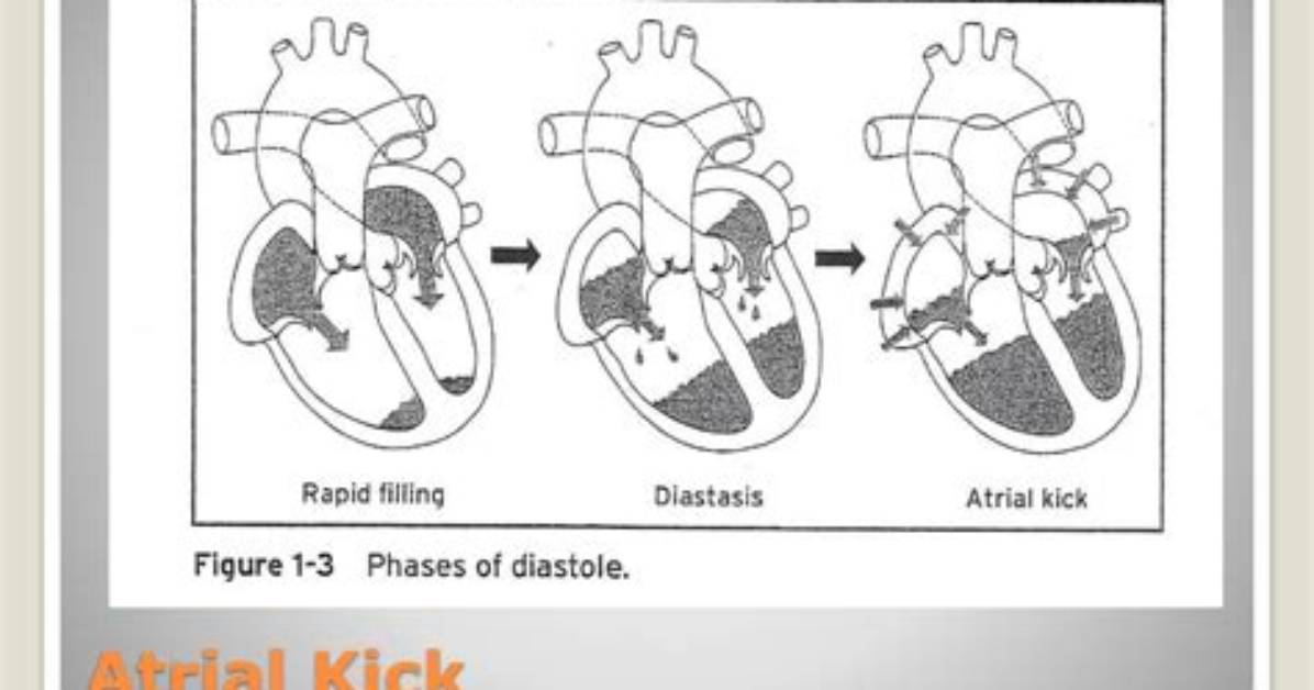 When Does Atrial Kick Occur