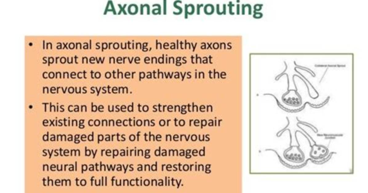 When Does Axonal Pruning Occur?