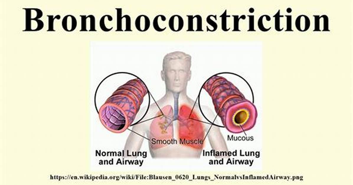 When Does Bronchoconstriction Occur?