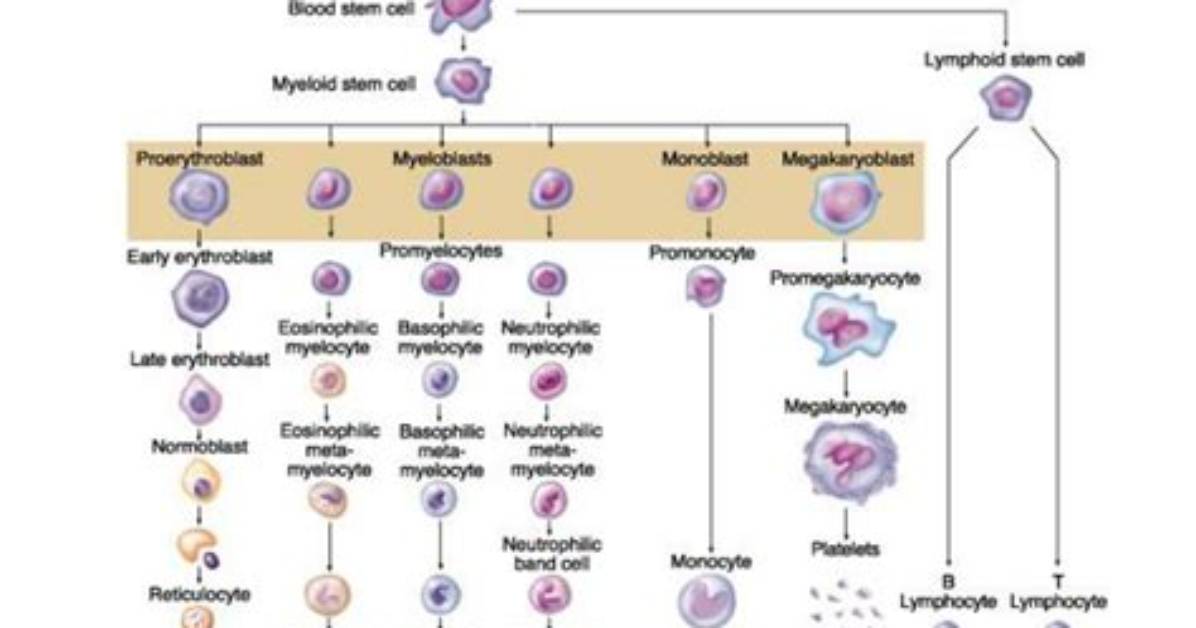 When Does Extramedullary Hematopoiesis Occur?