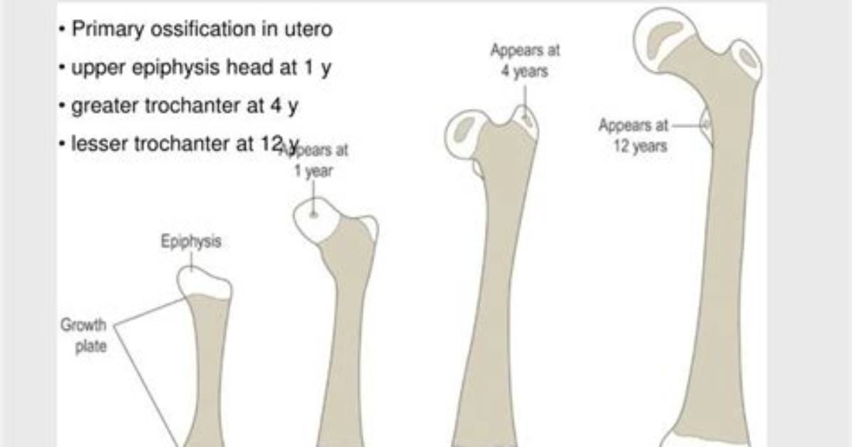 When Does Femoral Head Ossify?