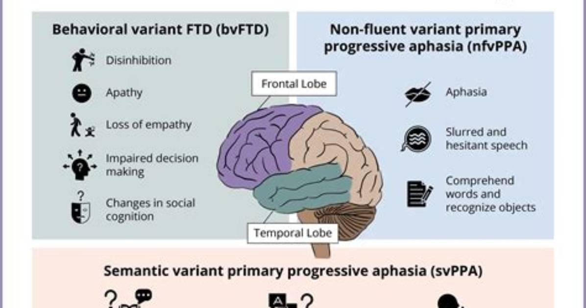 When Does Frontotemporal Dementia Start?