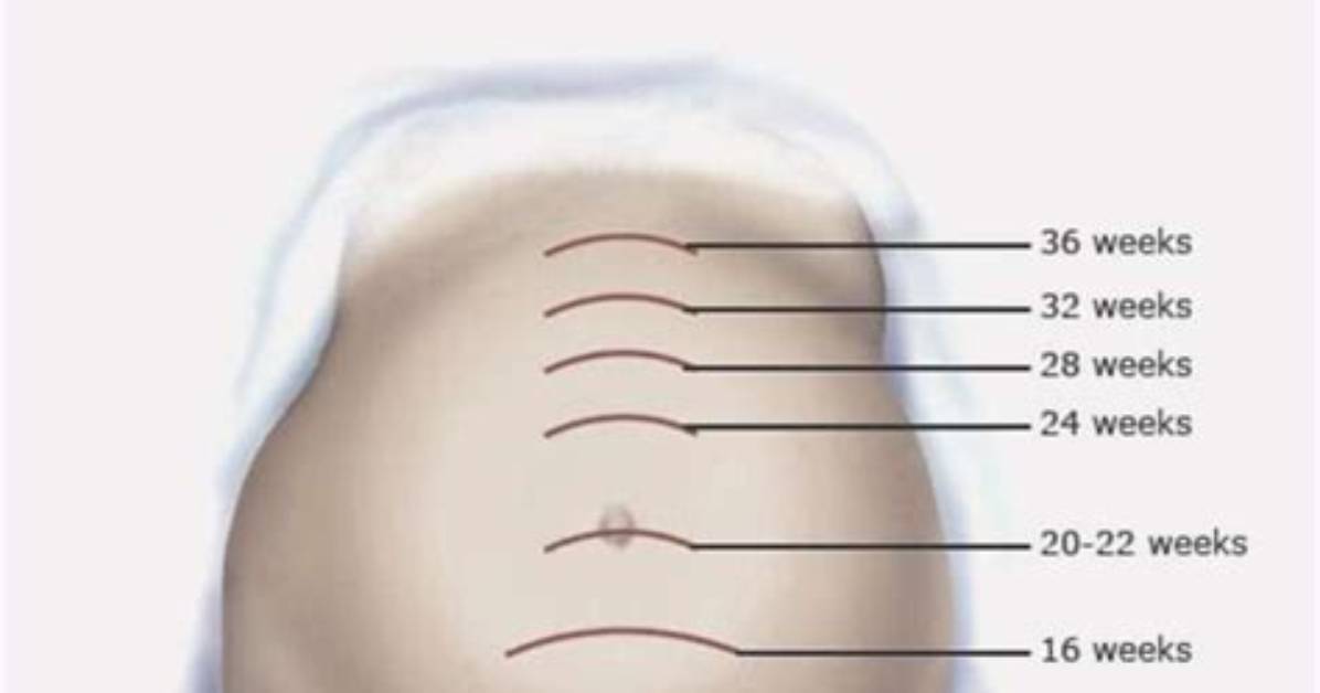 When Does Fundal Height Correlate with Gestational Age?