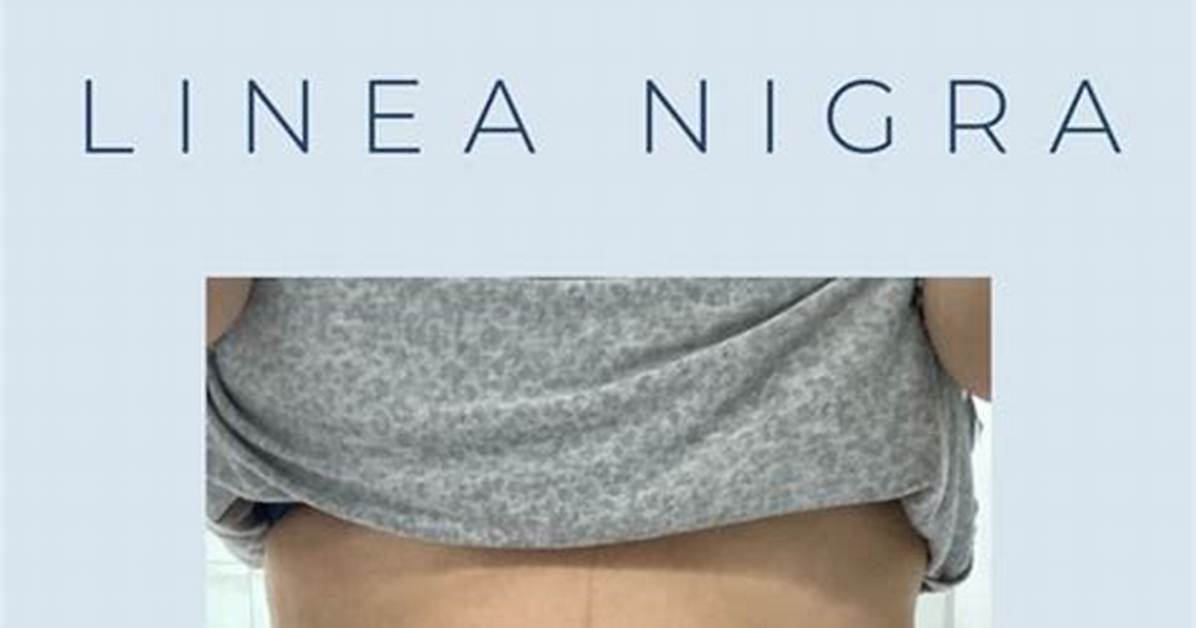 When Does Linea Nigra Appear?