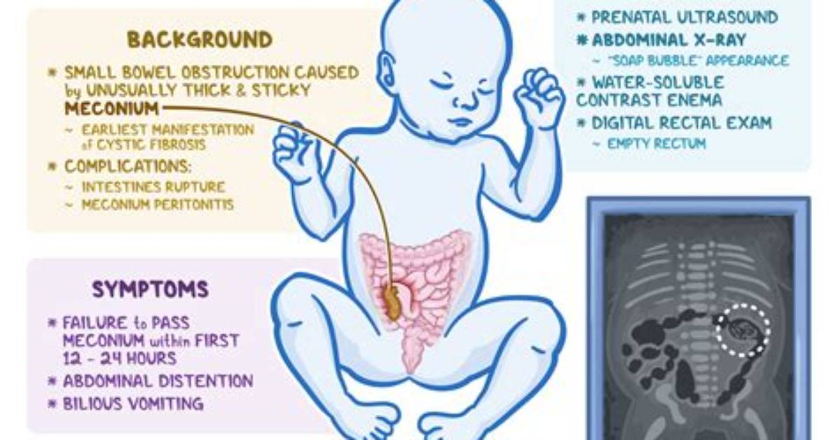 When Does Meconium Form?