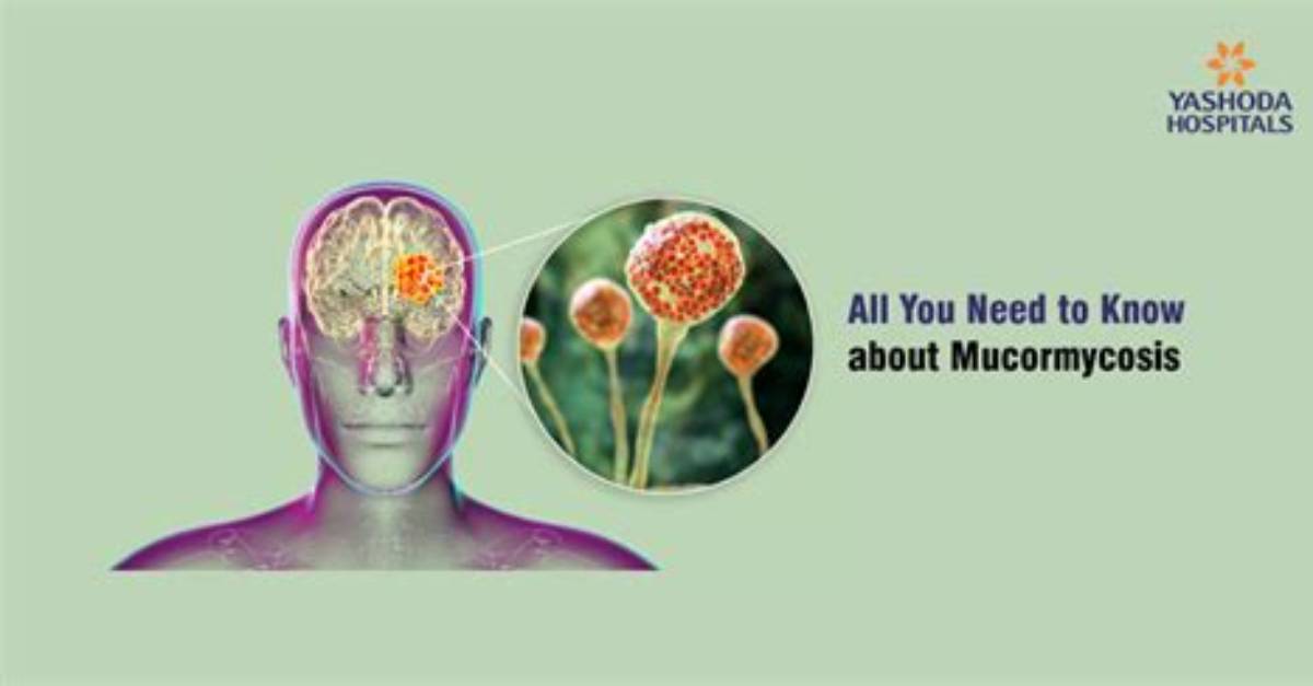 When Does Mucormycosis Happen?