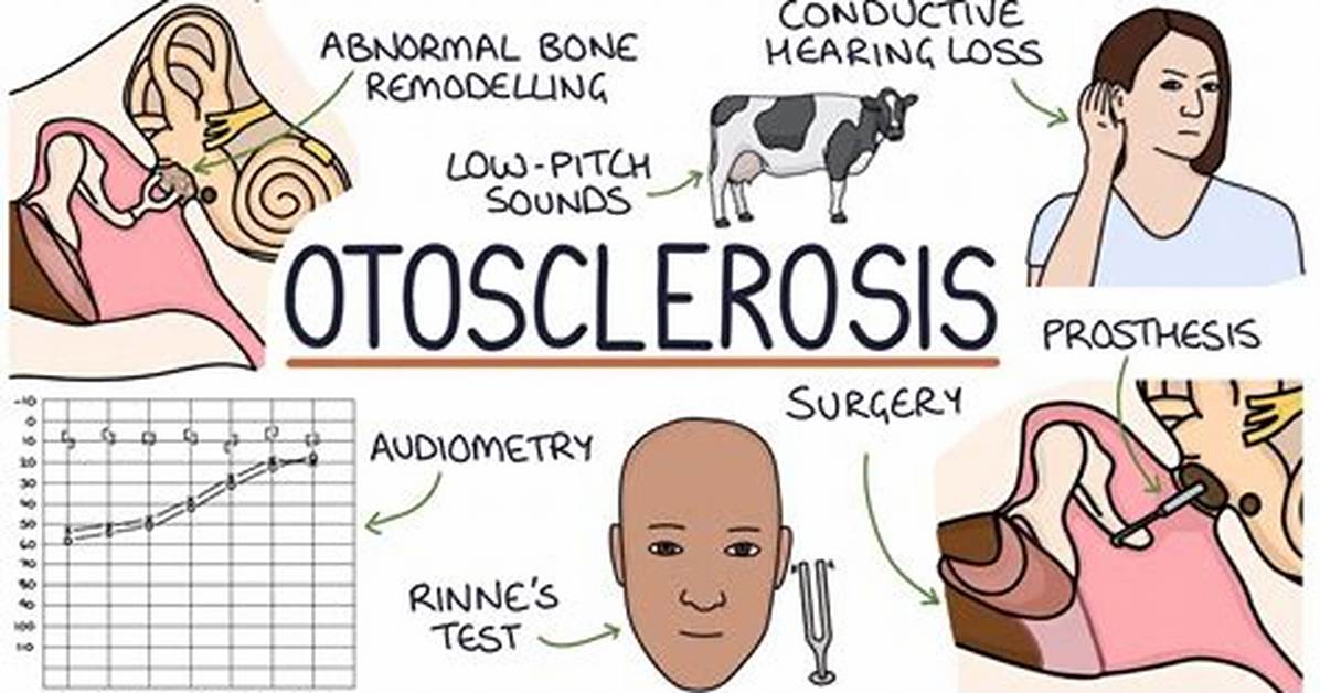 When Does Otosclerosis Occur?