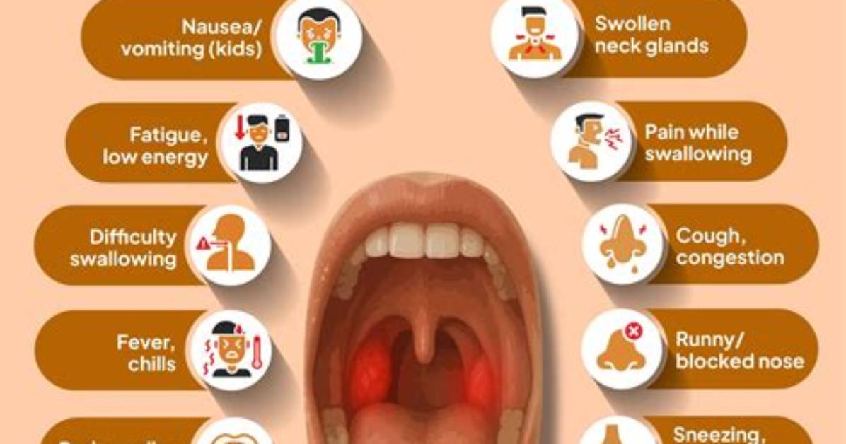 When Does Pharyngitis Go Away?