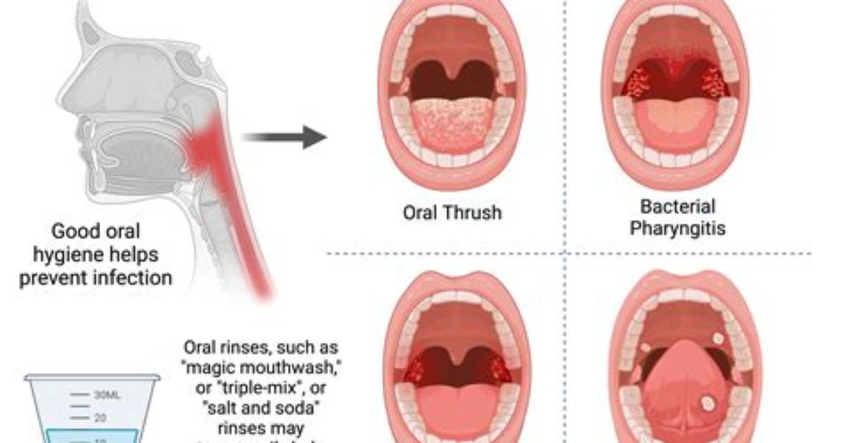 When Does Scratchy Throat Go Away?