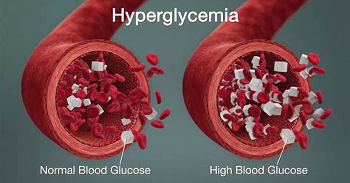 When Glucose Is High?
