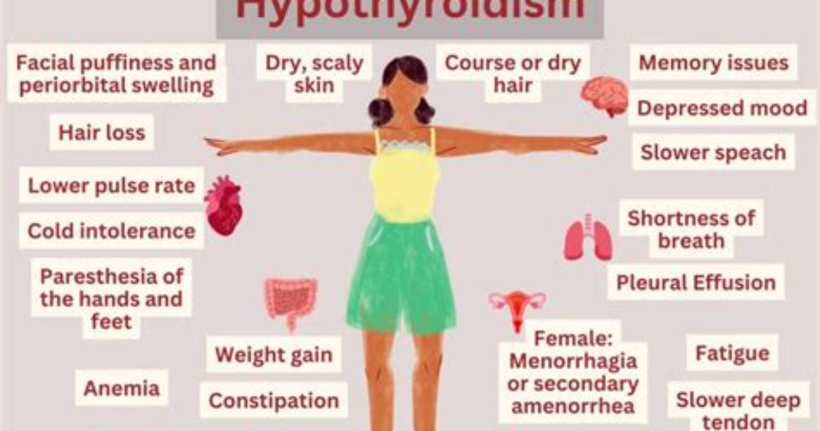 When Hypothyroidism Is Severe?