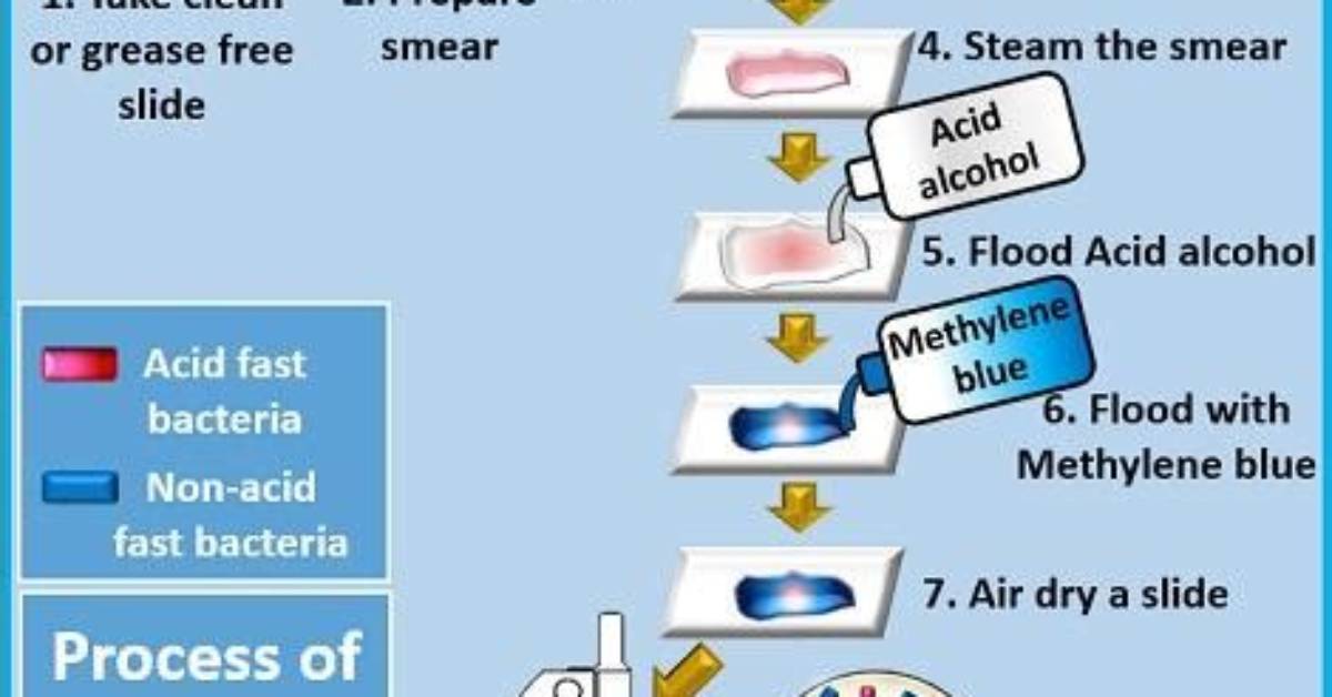 When Is Acid-Fast Staining Used?