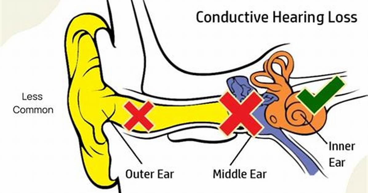 When Is Conductive Hearing Loss?
