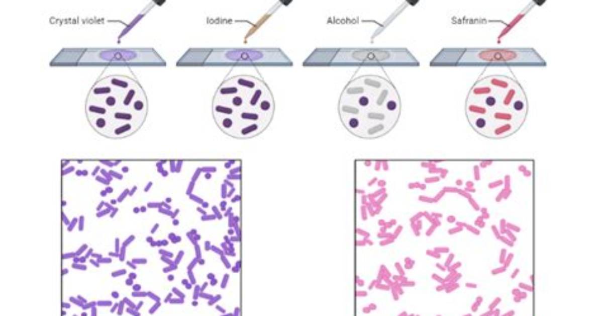 When Is Gram Staining Used?