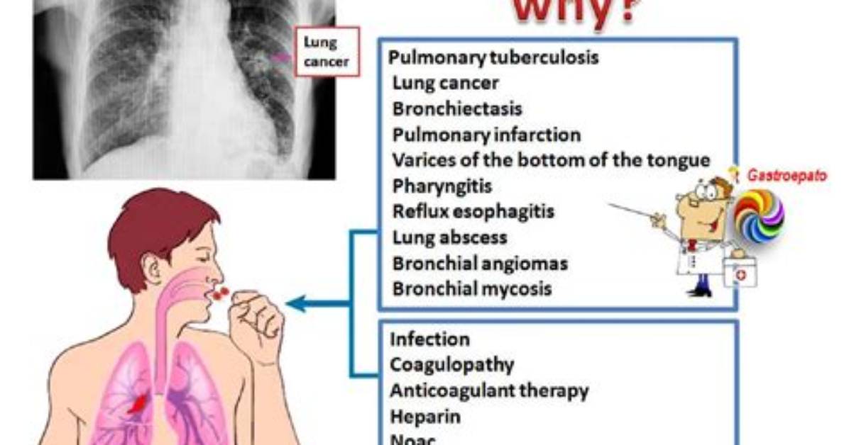 When Is Hemoptysis Dangerous?