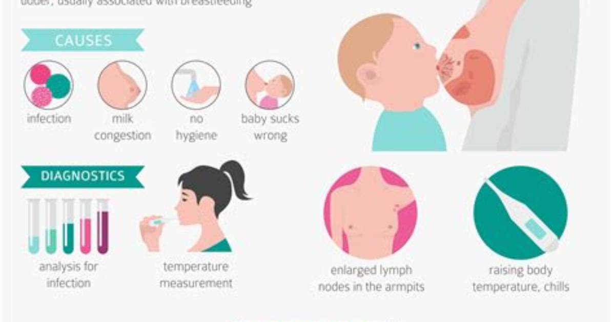 When Is Mastitis Dangerous?