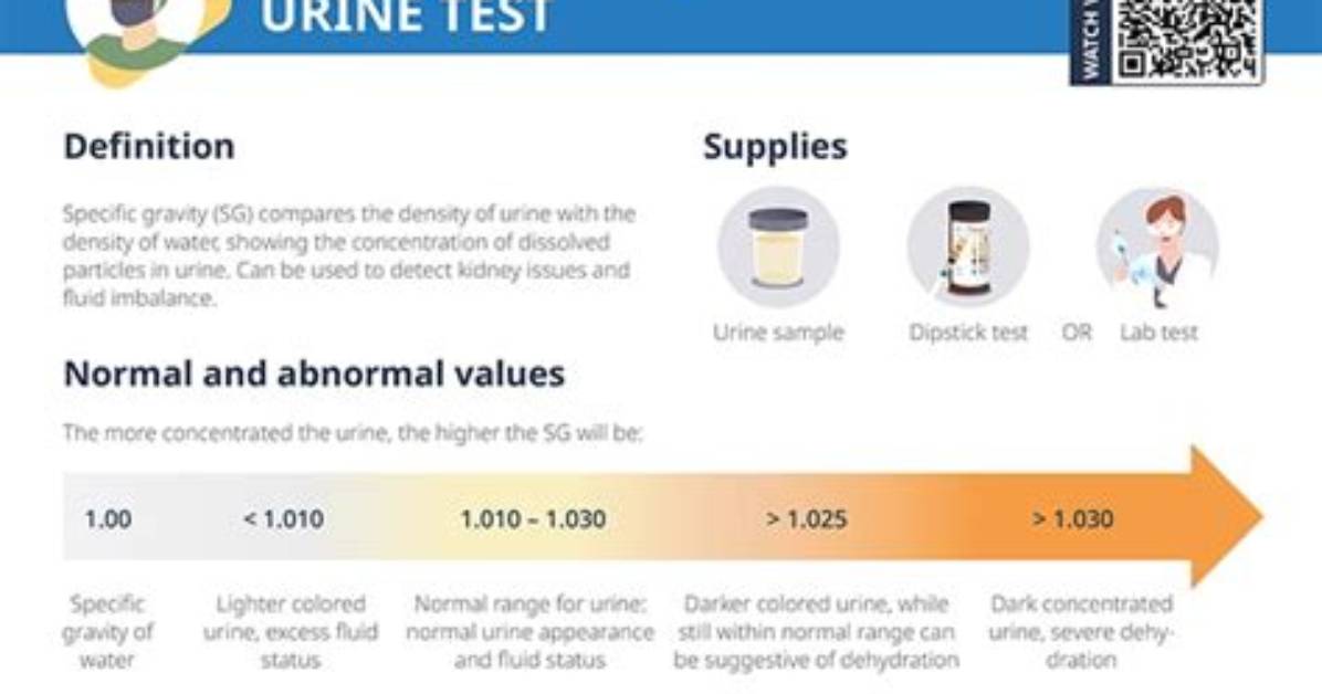 When Is Specific Gravity in Urine High?
