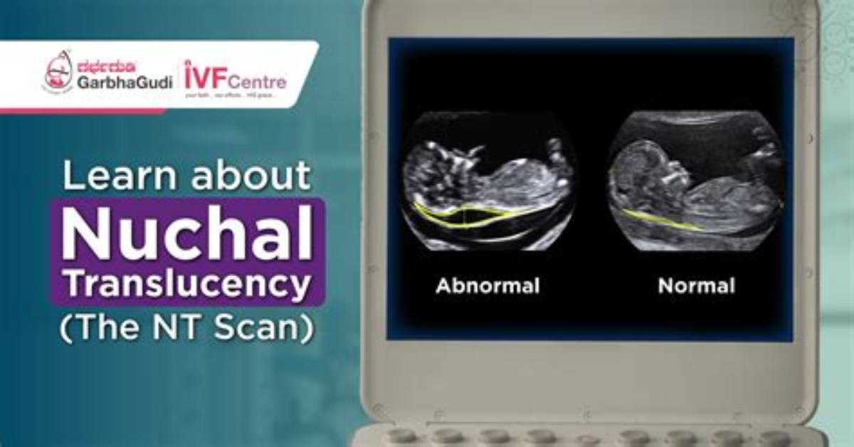 When Nuchal Is Done?