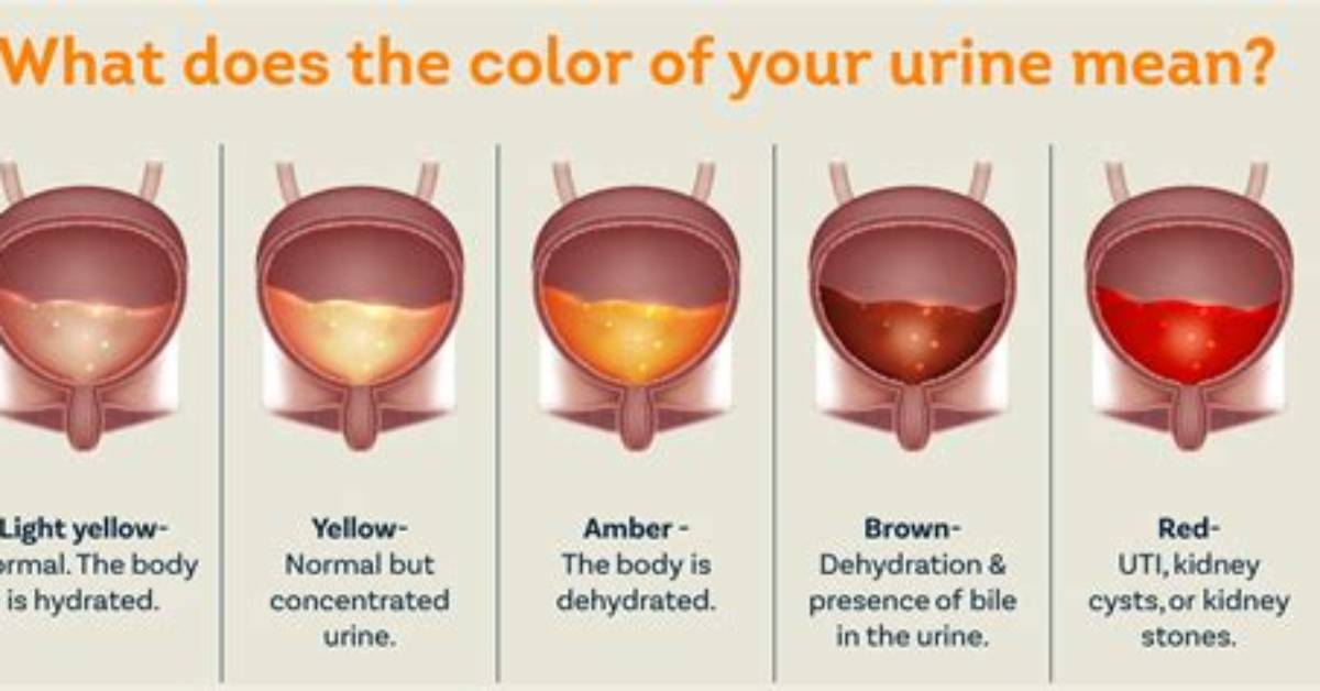 When One Urinates Blood?