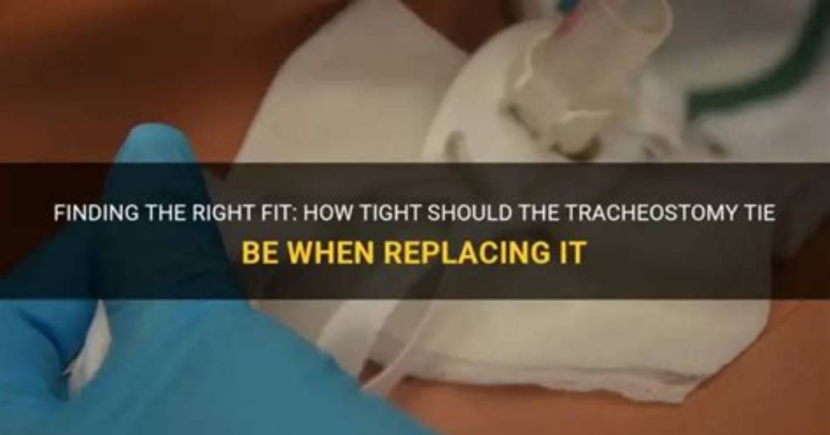 When Replacing the Tracheostomy Tie How Tight Should It Be?