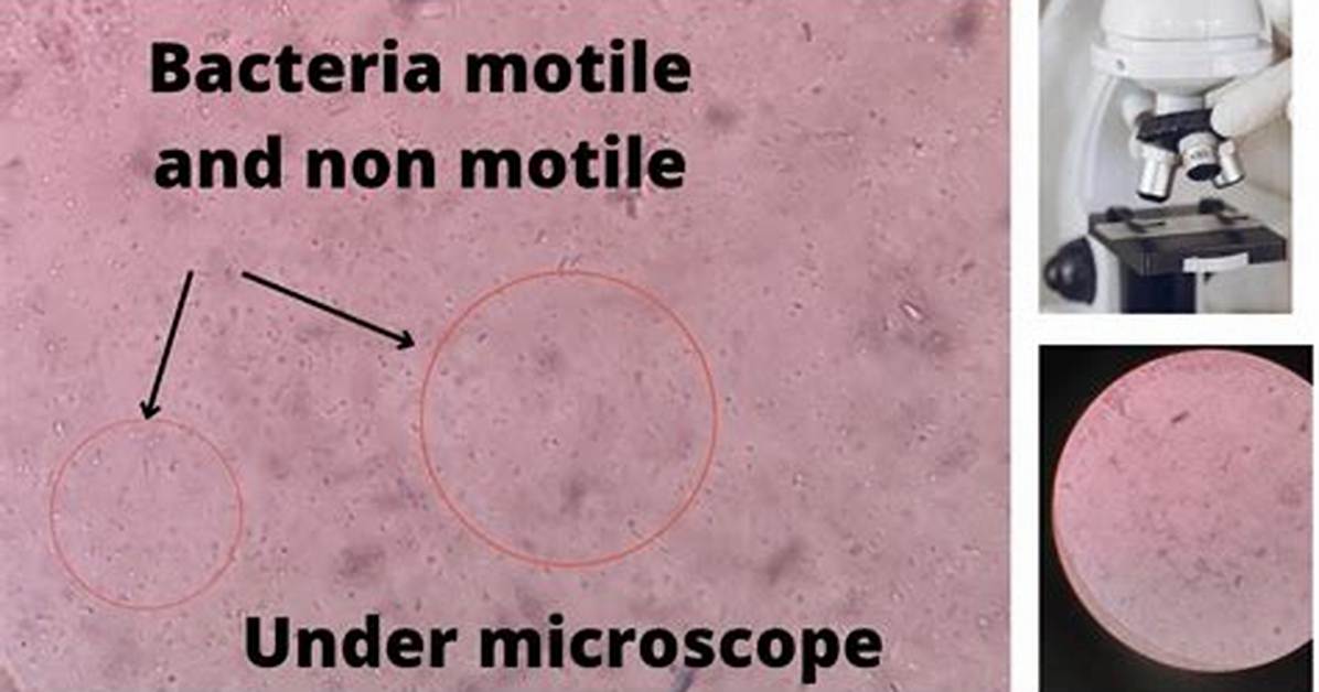 When Something Is Motile?