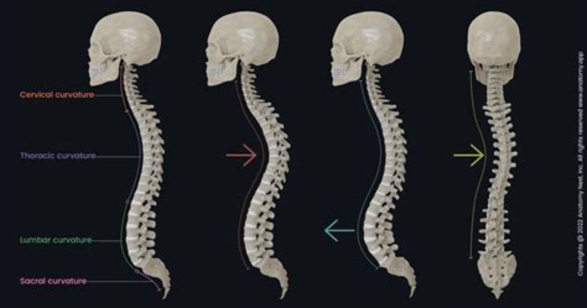 When Spine Is Curved?