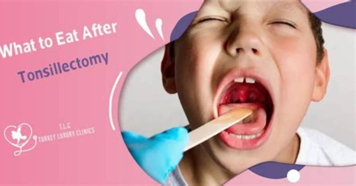 When to Eat After Tonsillectomy?