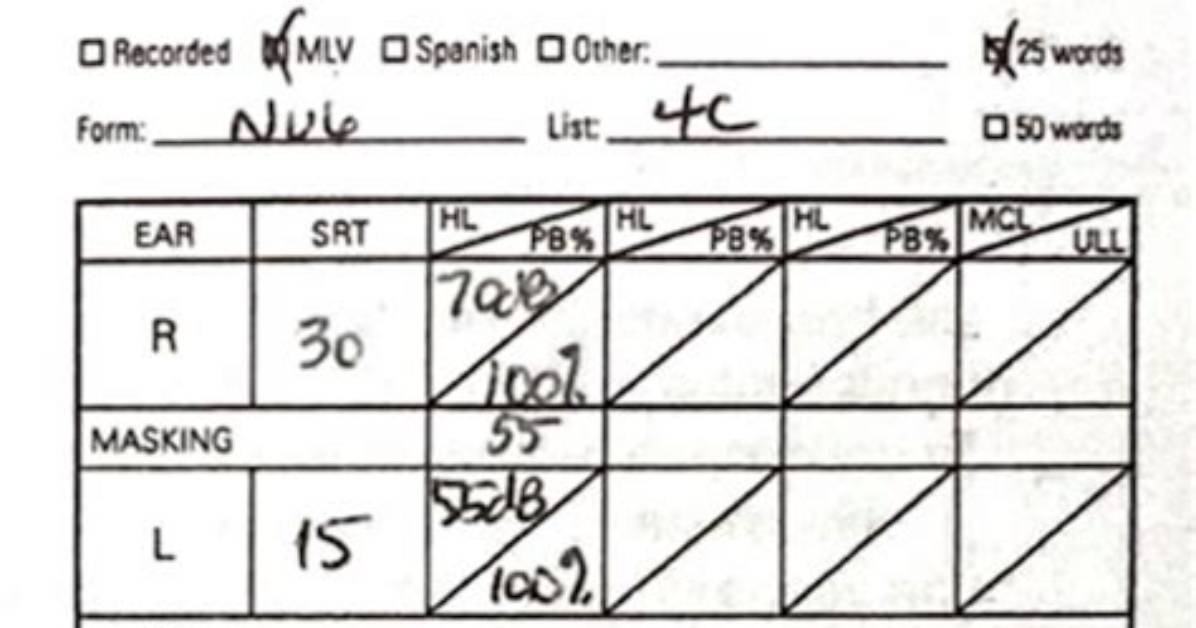When to Mask for Speech Audiometry?