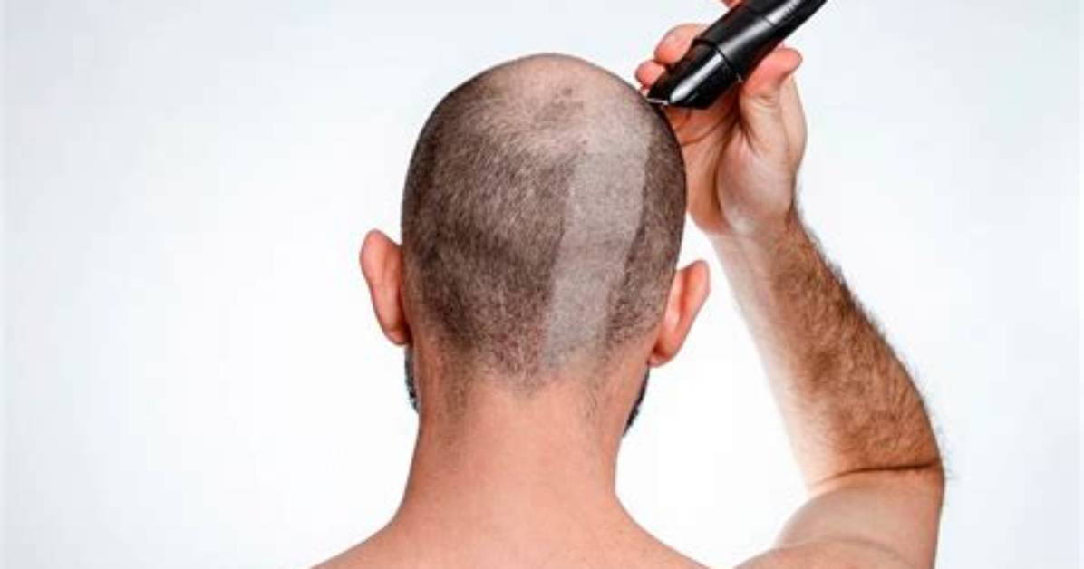 When to Shave Your Head?