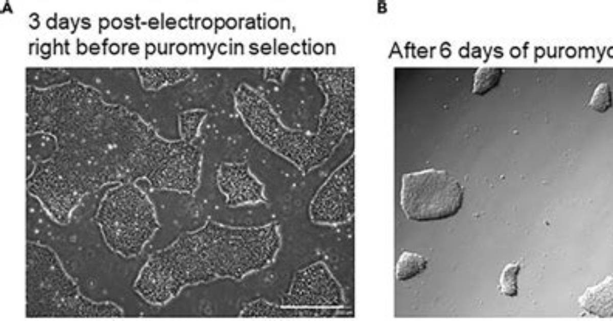 When to Start Puromycin Selection?