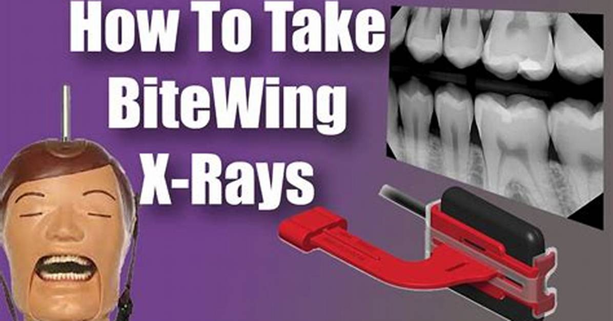 When to Take Bitewings?
