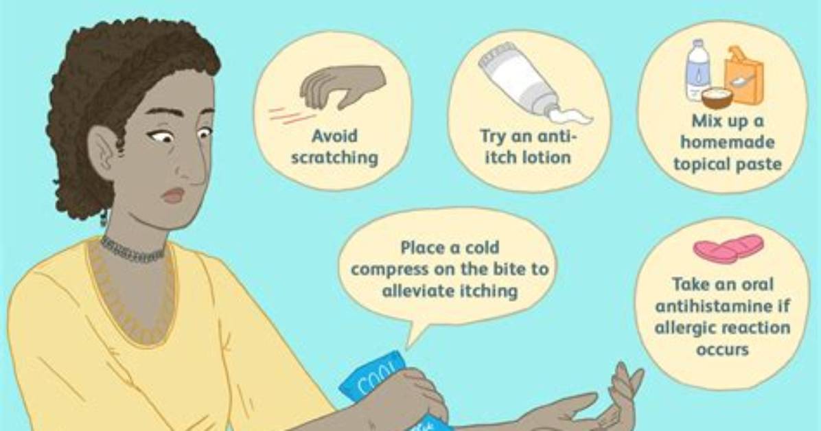 When to Treat Insect Bite?