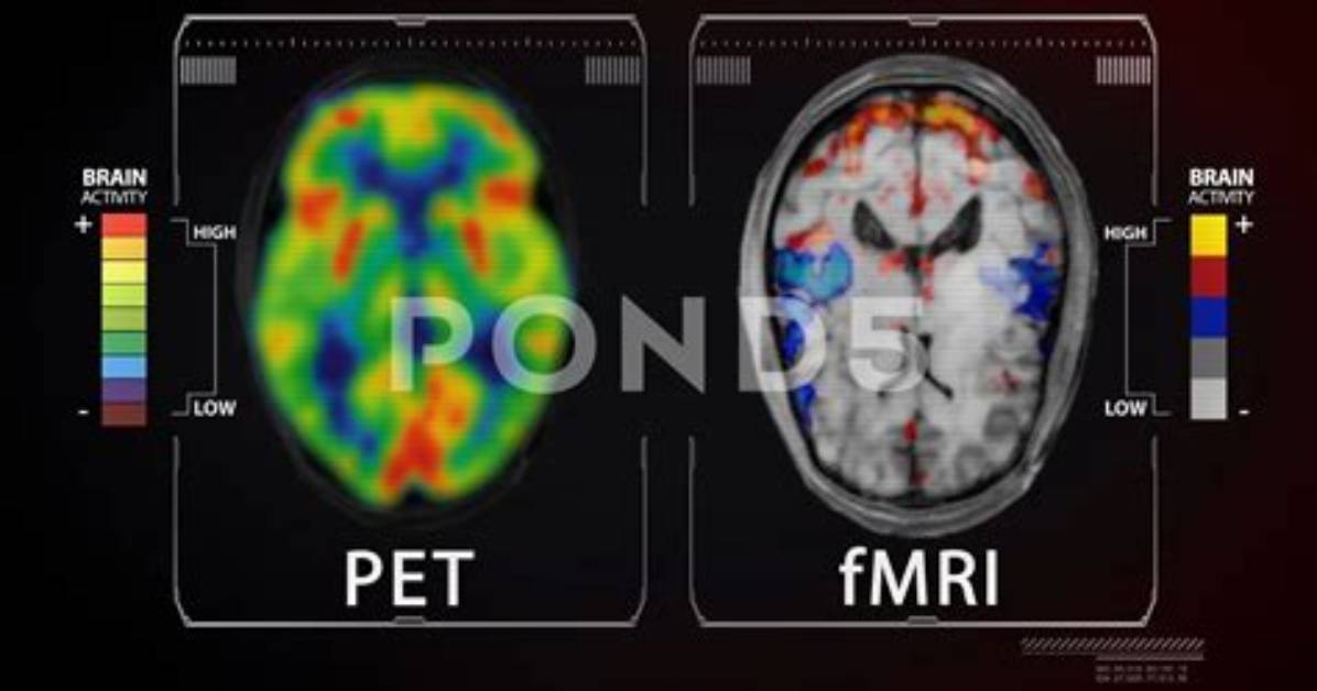 When to Use Fmri vs Pet?