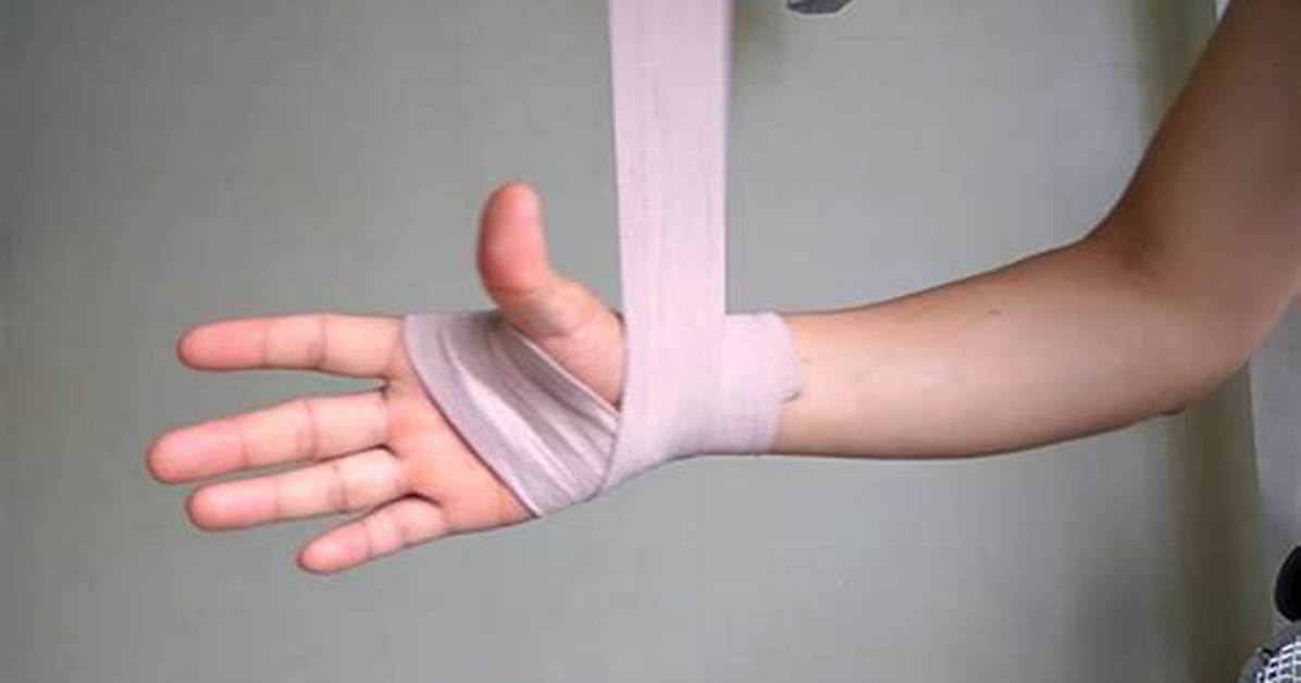 When to Wrap a Sprained Wrist?