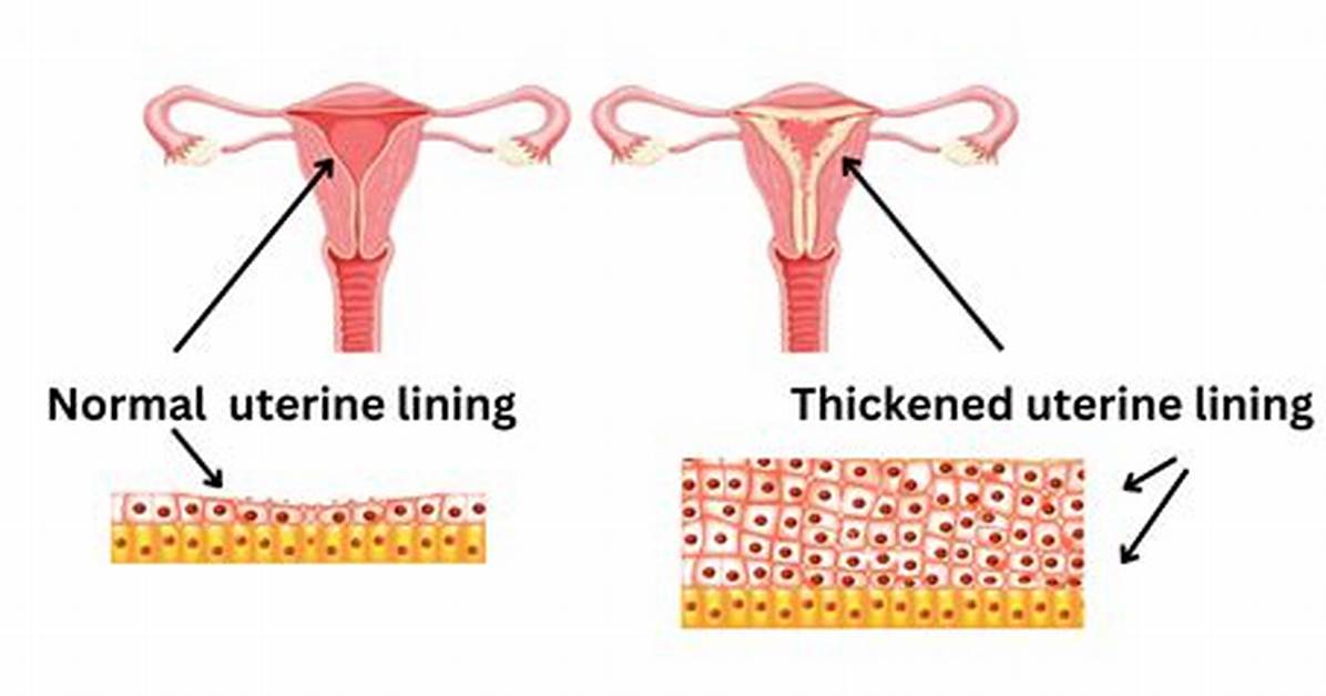 When Uterine Lining Is Thick?