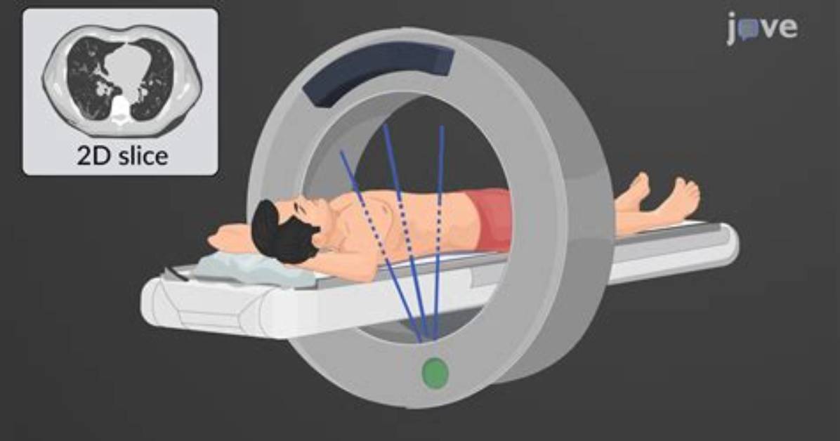 When Was Computed Tomography Invented?