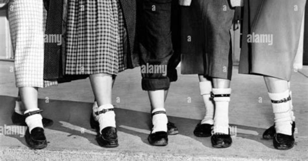 When Were Anklets Popular?
