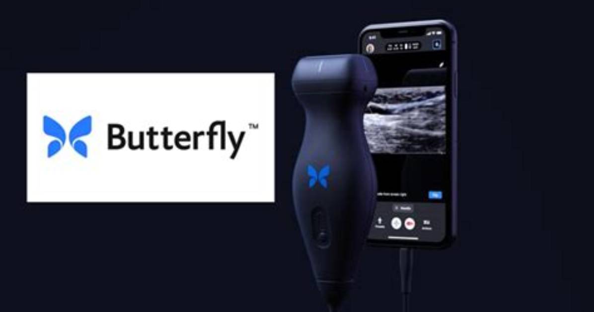 When Will Longview Merger with Butterfly?
