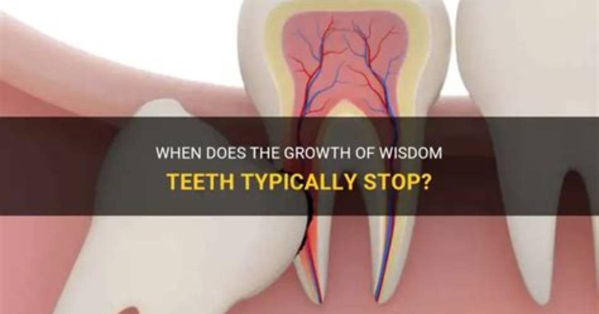 When Wisdom Teeth Stop Growing?