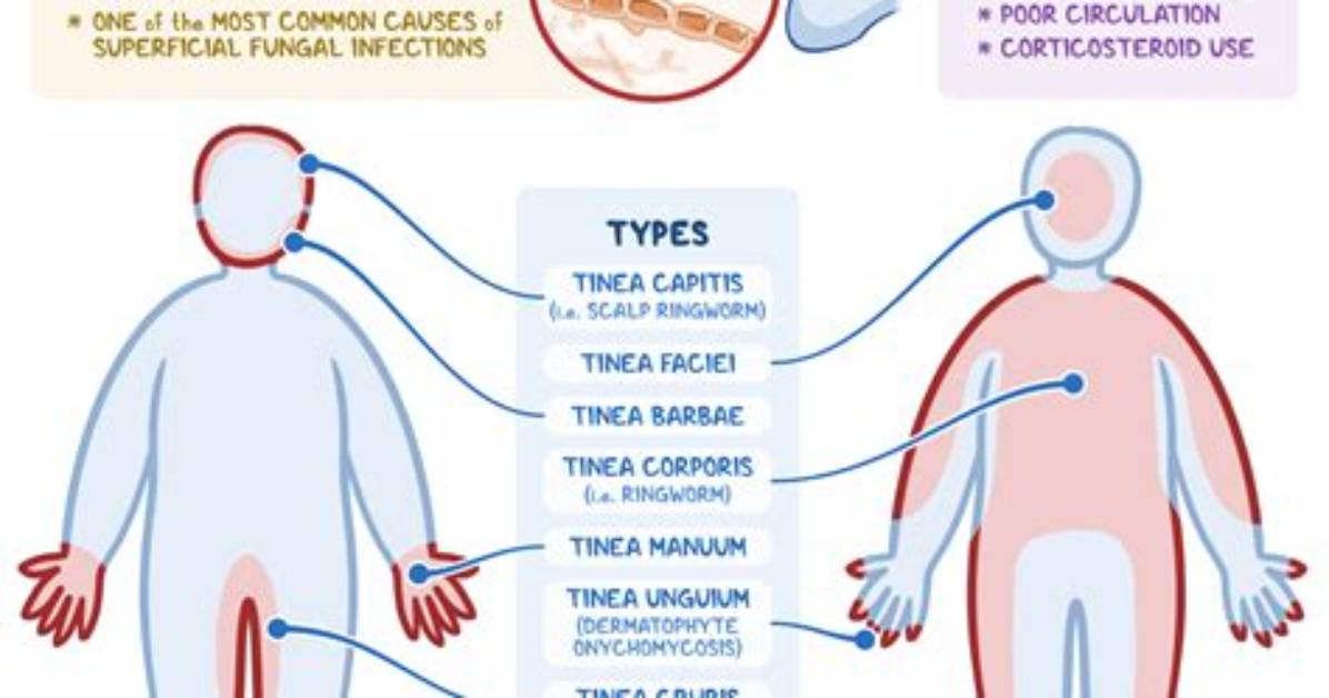 Where Are Dermatophytes Found?