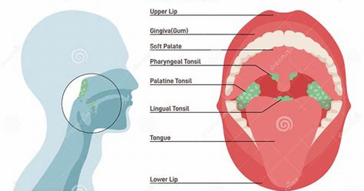 Where Are the 3 Tonsils Located?