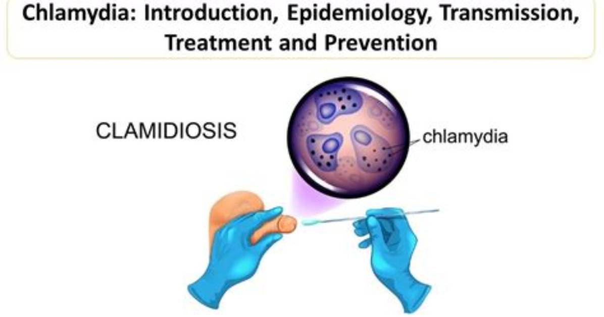 Where Chlamydia Originate from?