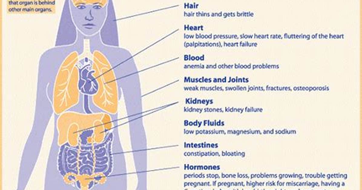 Where Did Anorexia Start?