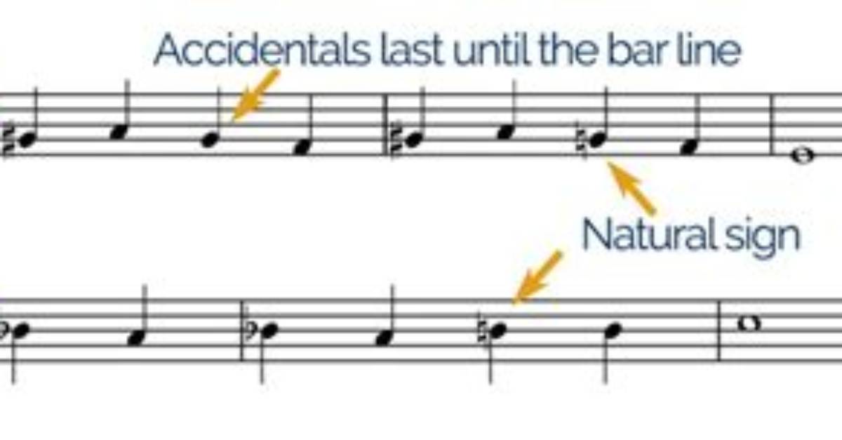Where Do Accidentals Go?
