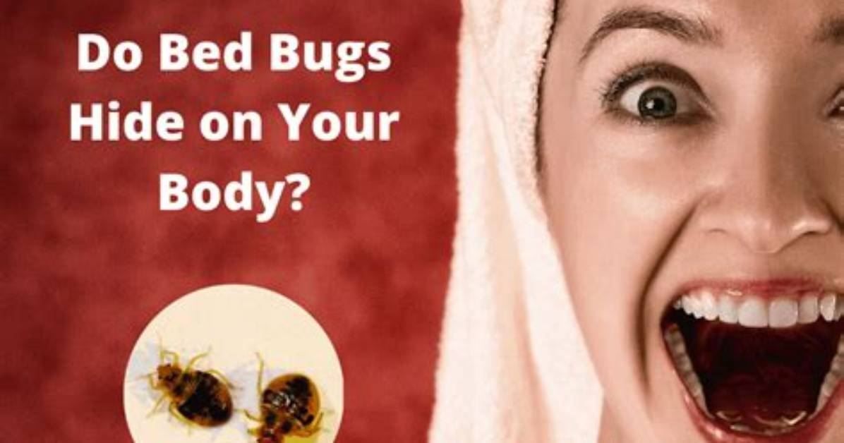 Where Do Bed Bugs Hide on Your Body?