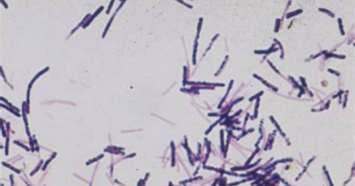 Where Do Dogs Get Clostridium?