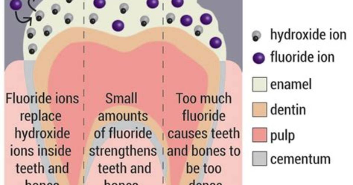 Where Do Fluorosis Come from?