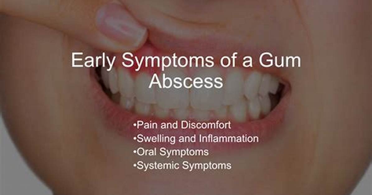 Where Do Gum Abscesses Come from?